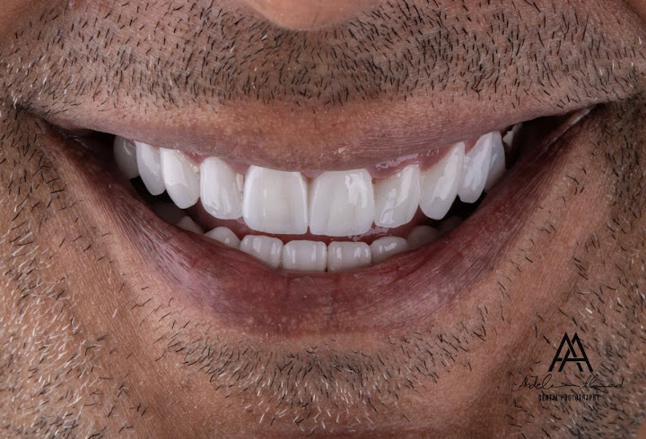 Dr. Bassem samir dental clinic - sheikh zayed | ويلب
